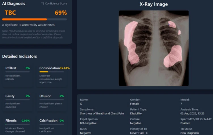 UGM kembangkan aplikasi skrining TBC berbasis AI pertama di Indonesia