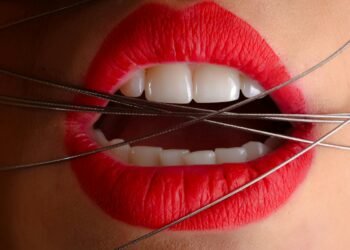 Ilustrasi kanker mulut